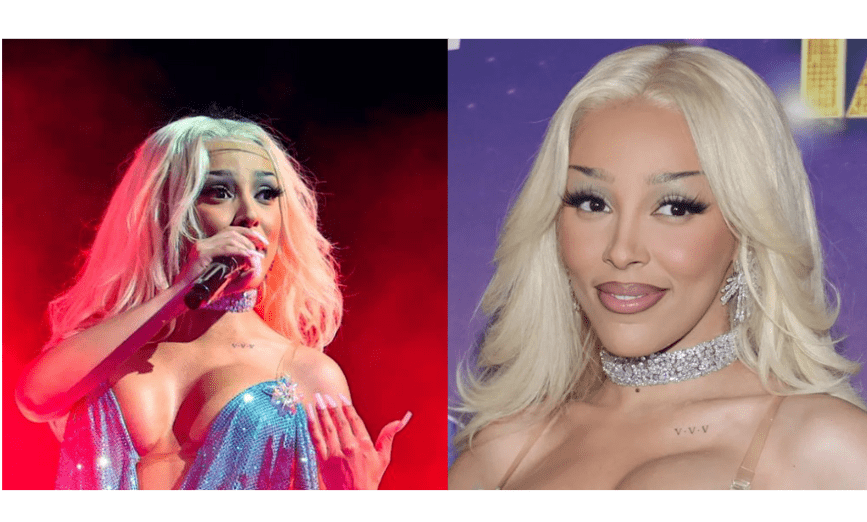 Doja Cat Plastic Surgery Doja Cat Plastic Surgery