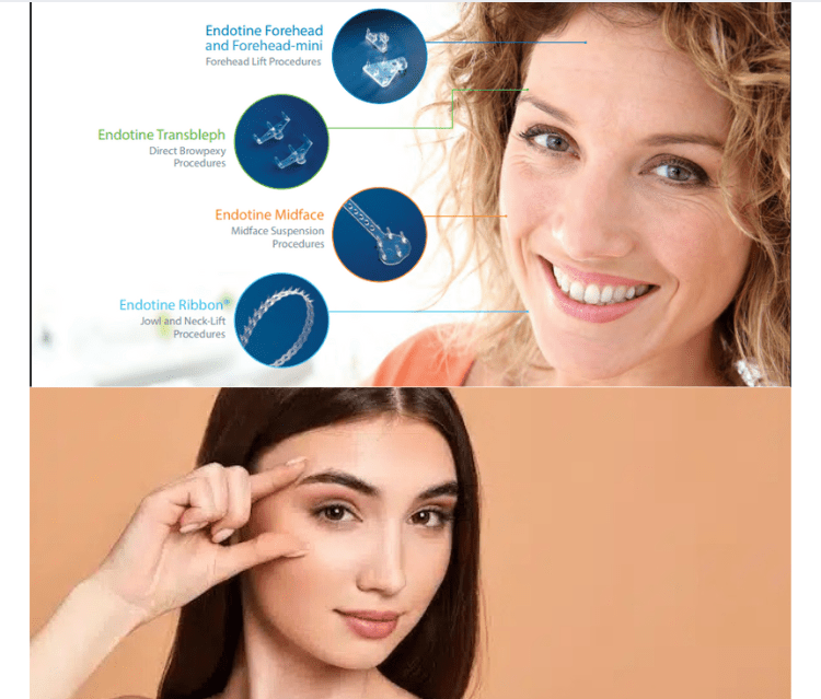 Endotine Surgery Endotine Surgery