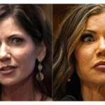 Kristi Noem Before Plastic Surgery