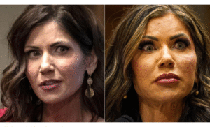 Kristi Noem Before Plastic Surgery, The Real Face Behind the
