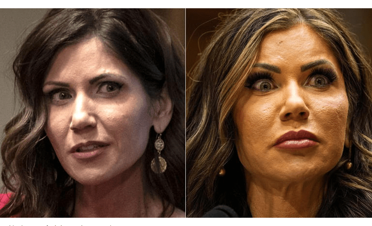 Kristi Noem Before Plastic Surgery Kristi Noem Before Plastic Surgery