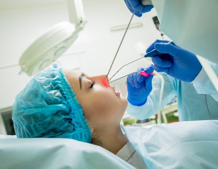 FESS Surgery FESS Surgery