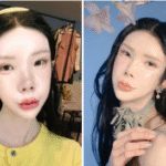 Lisa Yo Before Surgery