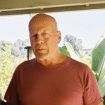 Bruce Willis Disease