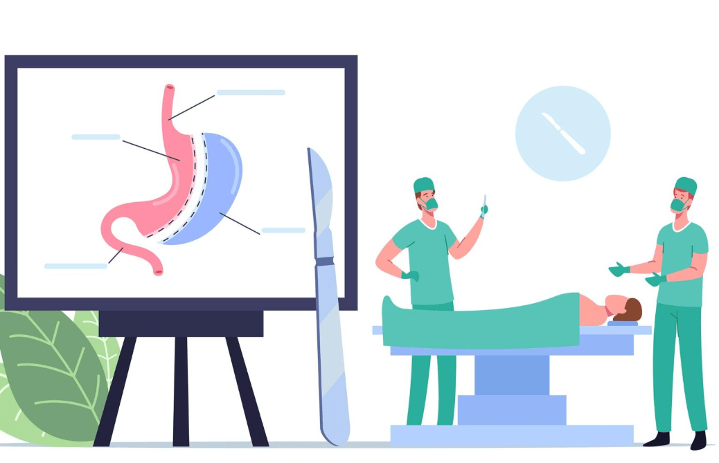 Gastric Sleeve Surgery