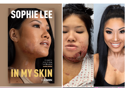 Sophie Lee Face Sophie Lee Face