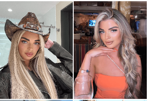 Helena Love Island Before Surgery
