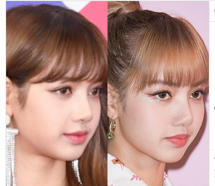 Lisa Blackpink Before Surgery