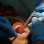 Osseous Surgery