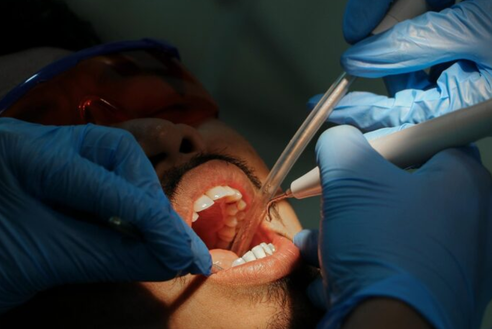 Osseous Surgery