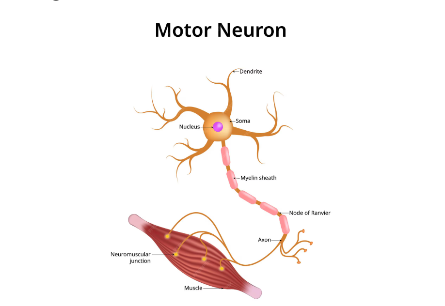 Rugby Player Motor Neurone Disease Rugby Player Motor Neurone Disease