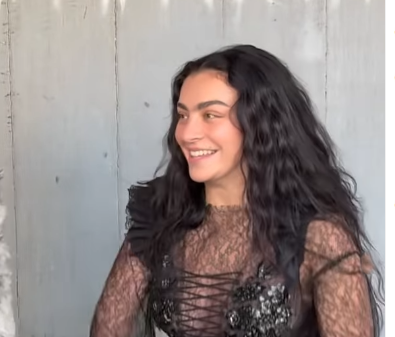 Charli XCX Plastic Surgery