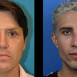 James Mack Plastic Surgery