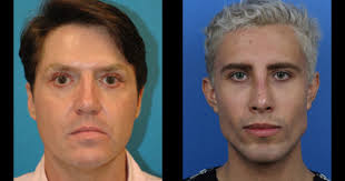 James Mack James Mack